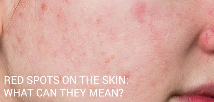 spots skin mean health